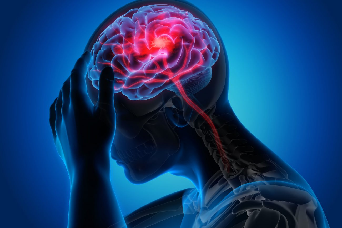 Can I get car insurance after a minor stroke Can I get car insurance after a minor stroke